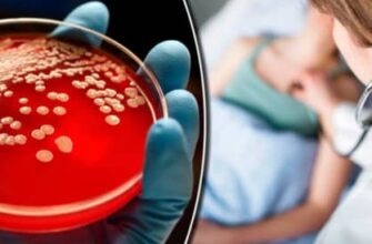 Ефективні методи лікування та вибір ліків від стафілококової інфекції