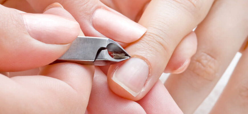 Ефективні методи лікування задирок на пальцях: поради та засоби