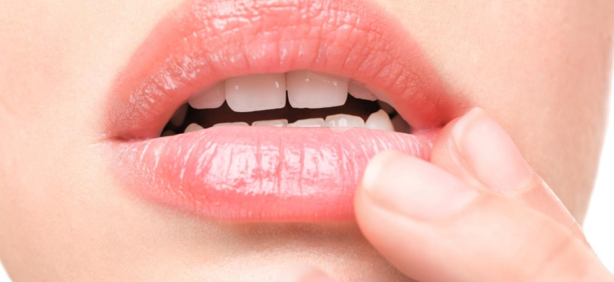 Ефективні методи лікування заїд на губах: огляд найкращих засобів