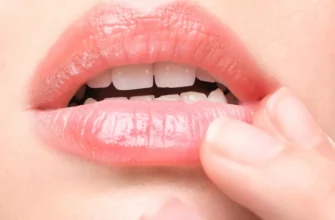 Ефективні методи лікування заїдів в домашніх умовах: поради та рекомендації