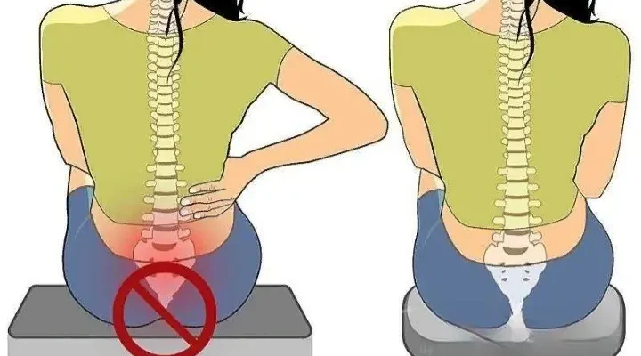 Ефективні методи полегшення болю в районі копчика: поради та лікування