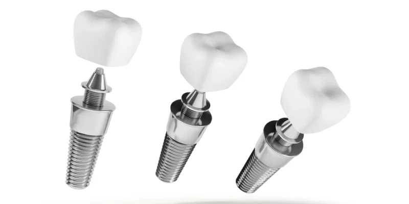 Ефективні методи та поради: що швидко знімає сильний зубний біль