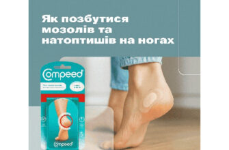 Ефективні методи та засоби лікування мозолів: що обрати?