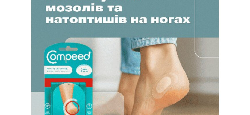 Ефективні методи та засоби лікування мозолів: що обрати?