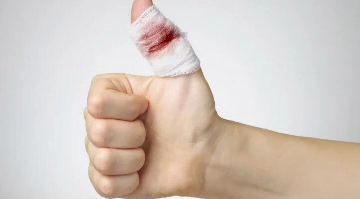 Ефективні методи зупинки крові з пальця: перевірені поради.