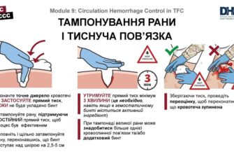 Ефективні методи зупинки кровотечі: перша допомога та поради