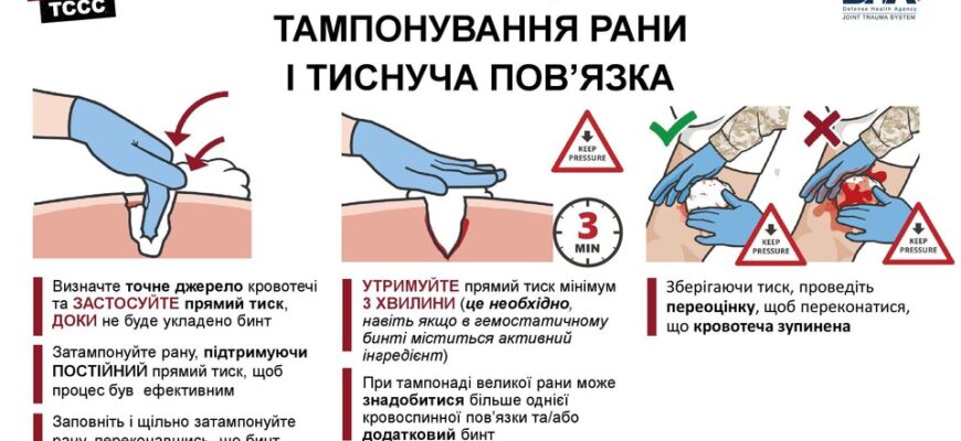 Ефективні методи зупинки кровотечі: перша допомога та поради Ефективні методи зупинки кровотечі: перша допомога та поради