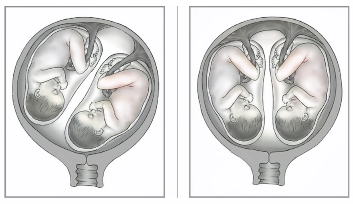 ДИКЛОФЕНАК-ДАРНИЦЯ розчин для ін'єкцій 25 мг/мл ампули 3 мл №10 ...