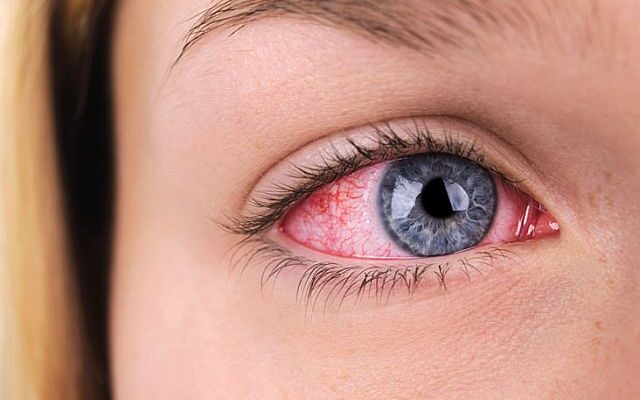 Ефективні способи промивання ока в домашніх умовах: покроковий гайд Ефективні способи промивання ока в домашніх умовах: покроковий гайд