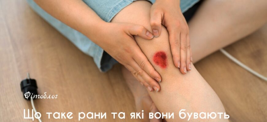 Ефективні способи витягнення гною з рани: кращі методи та поради