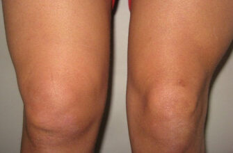 Ефективні способи зняти набряк ніг: домашні методи та поради лікарів