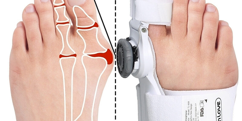 Ефективні засоби для зменшення болю та набряку кісточки на нозі