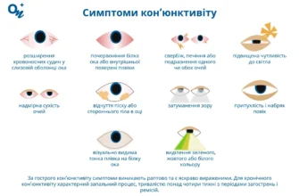 Ефективні засоби та методи лікування кон’юнктивіту в домашніх умовах