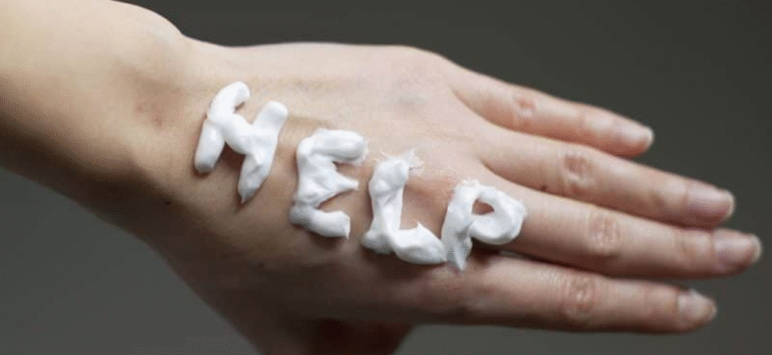 Ефективні засоби та методи лікування тріщин на руках в домашніх умовах