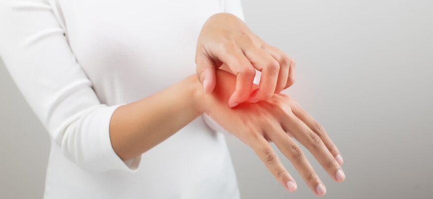 Ефективні засоби та поради, як зняти свербіж шкіри швидко і безпечно