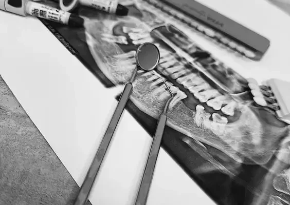 Фібрин після видалення зуба: що це і як впливає на загоєння?