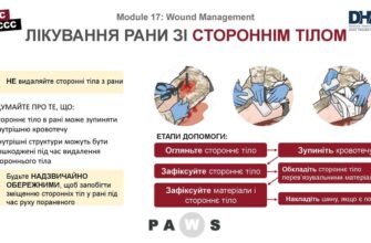 H1: Що робити, якщо у вас в рані виявлено стороннє тіло: поради лікарів