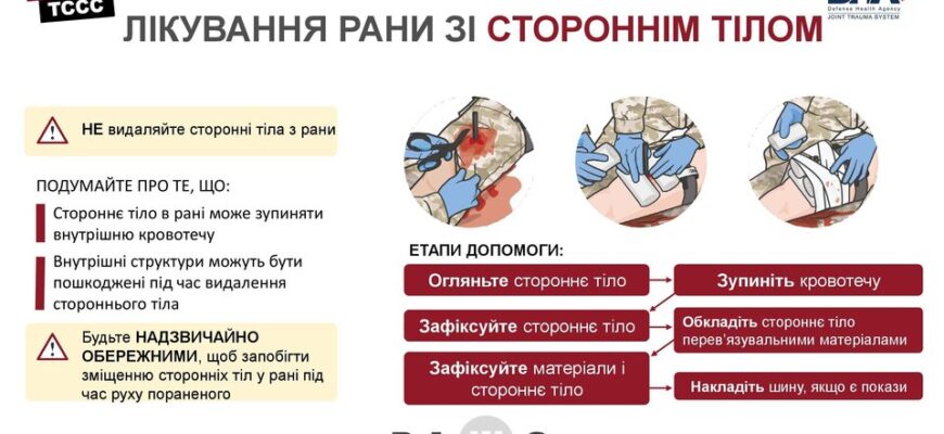 H1: Що робити, якщо у вас в рані виявлено стороннє тіло: поради лікарів