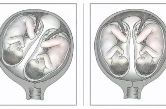 Головний біль при вагітності: що можна приймати без шкоди мамі і малюку