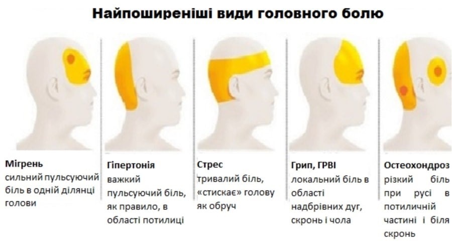 Що робити, якщо болить голова – Новоград.City