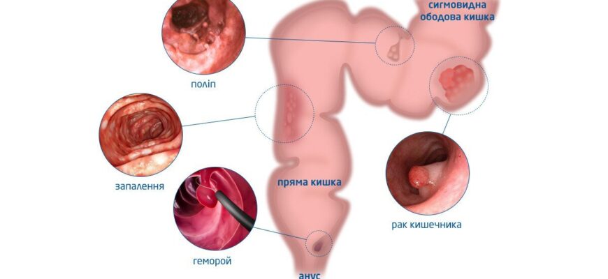Гостра біль у животі: Причини, симптоми та методи лікування