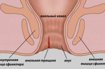 Гострий біль в задньому проході: причини, симптоми та лікування