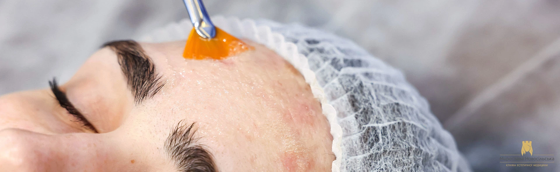 Карбоновий пілінг👌 Основні ефекти та переваги: · Глибоке очищення пор і  зменшення їх розміру. · Зменшення видимості чорних точок та активності  сальних залоз. · Покращення текстури та рельєфу шкіри, ...