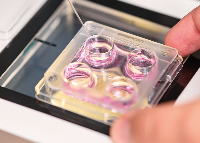 ЕКЗ - ціна на штучне запліднення у Києві | МЦ «Мати та дитина»