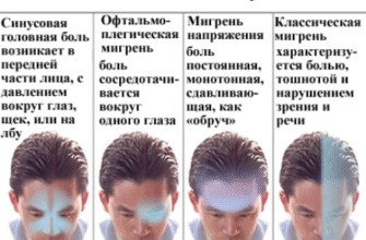 Кластерний біль: причини, симптоми та ефективні методи лікування