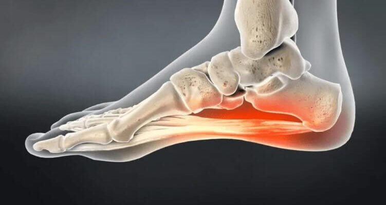 Колючий біль у п’яті: основні причини та методи лікування