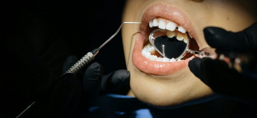 Коли і скільки часу варто зачекати перед їжею після чищення зубів?