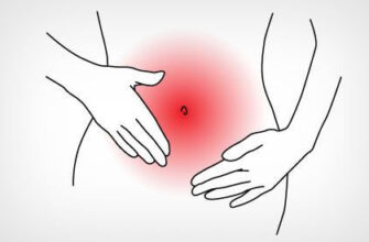 Кровотеча після місячних: причини, симптоми та методи лікування