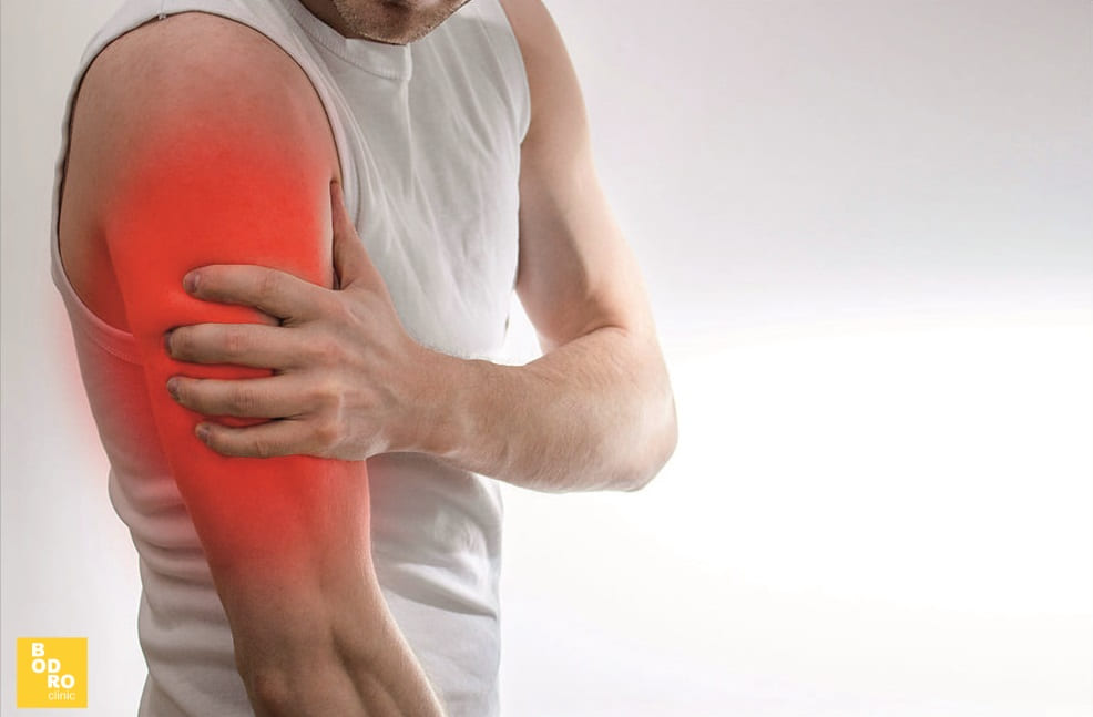Тендиніт | Bodro Clinic