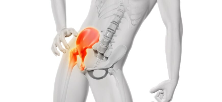 Лікування болю в тазостегновому суглобі: ефективні методи та поради