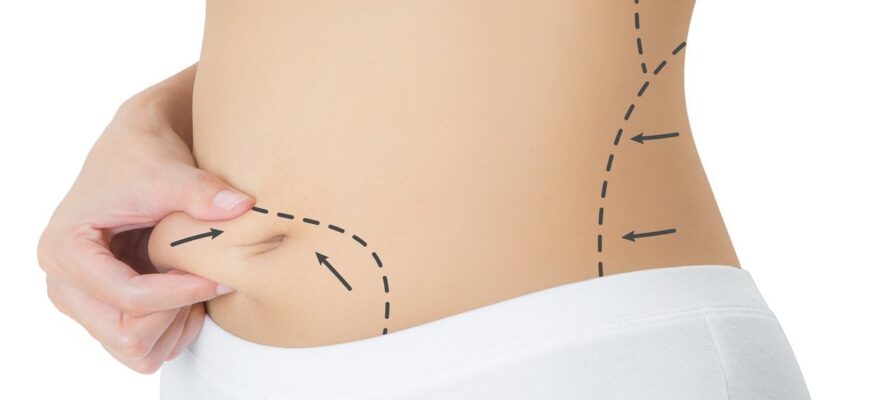 Ліпофілінг грудей: результати та зміни до і після процедури