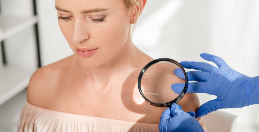 Лишай у людини: види, діагностика та лікування - ДІЛА БЛОГ