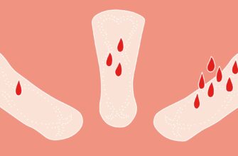 Місячні після видалення труби: що очікувати та як вплине на цикл?