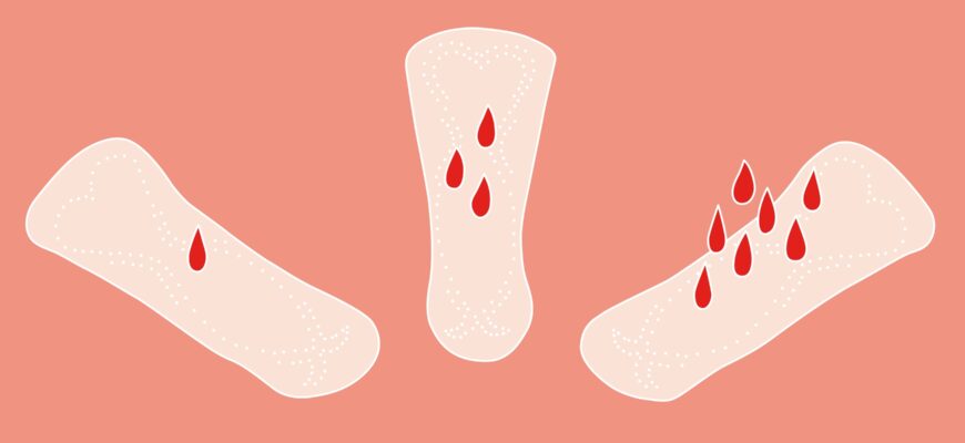 Місячні після видалення труби: що очікувати та як вплине на цикл?