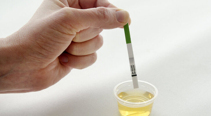 На який день тест показує вагітність після зачаття: детальний гайд