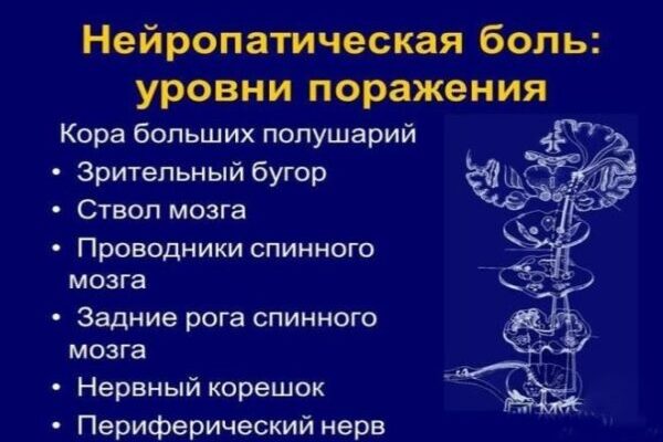 Неврологічний головний біль: симптоми, які мають насторожити вас
