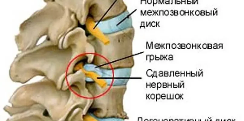 Ниючий біль у ямці: причини, симптоми та ефективні методи лікування
