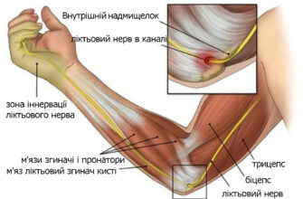 Ниючий біль у лікті: основні причини та ефективні методи лікування