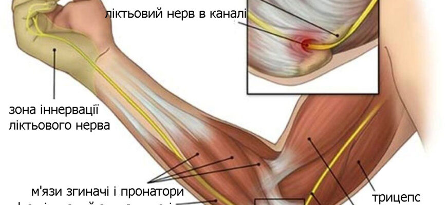 Ниючий біль у лікті: основні причини та ефективні методи лікування