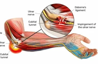 Ниючий біль в правій руці: основні причини і методи лікування