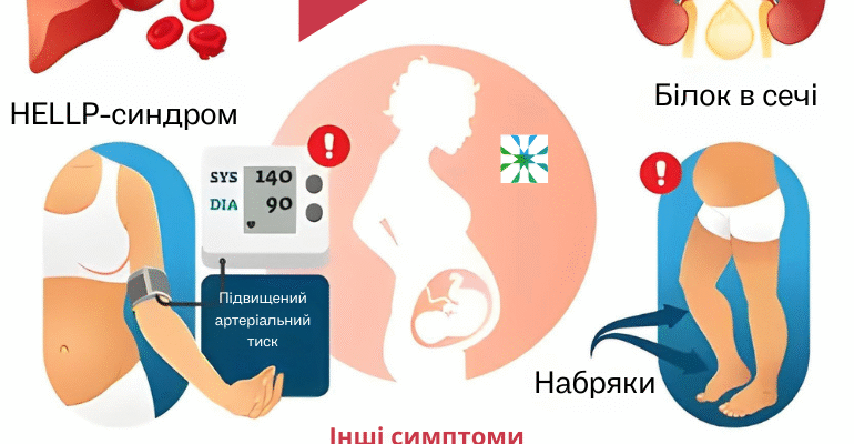 Обговорення та поради: вагітність після завмерлої вагітності на форумі