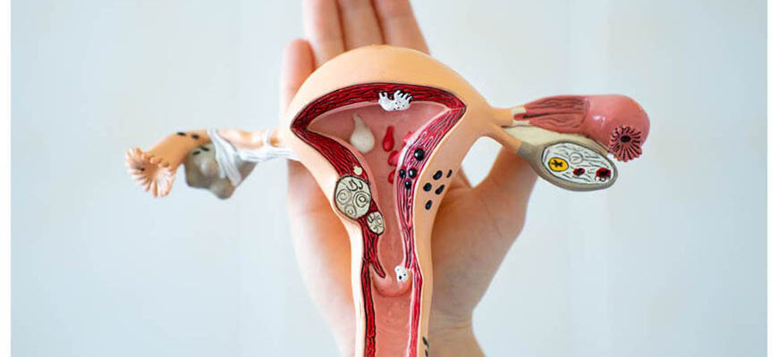 Очікувана тривалість життя після видалення матки: основні фактори