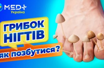 Оніхолізис після гель-лаку: причини, симптоми та лікування нігтів