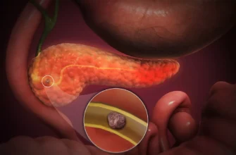 Оперізуючий біль: причини, симптоми та ефективні методи лікування