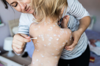 Оптимальні засоби для зниження температури при вітрянці у дітей