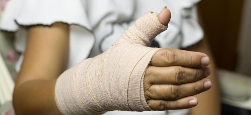 Оптимальний час для розробки руки після перелому: рекомендації лікарів